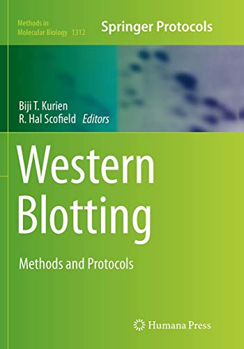 Western Blotting: Methods and Protocols (Methods in Molecular Biology, 1312, Band 1312)