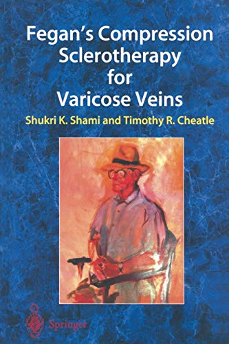 Fegan's Compression Sclerotherapy for Varicose Veins