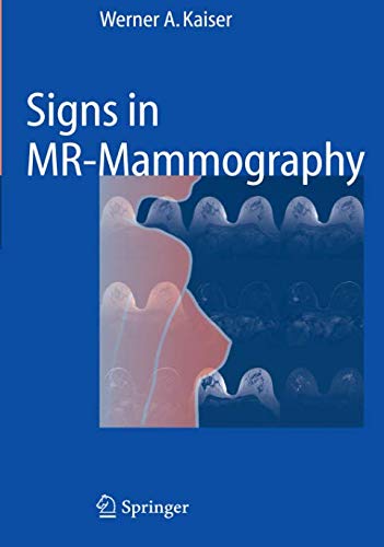 Signs in MR-Mammography