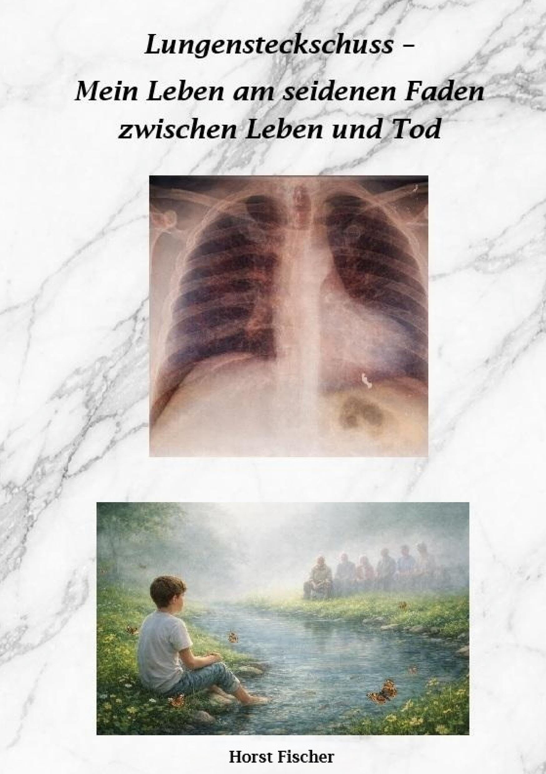 Lungensteckschuss - Mein Leben am seidenen Faden zwischen Leben und Tod
