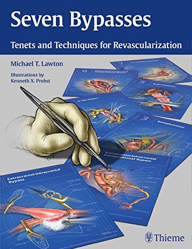Lawton, Michael T Seven Bypasses, Tenets And Techniques For Revascularization