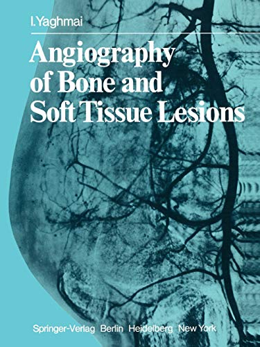 Angiography of Bone and Soft Tissue Lesions