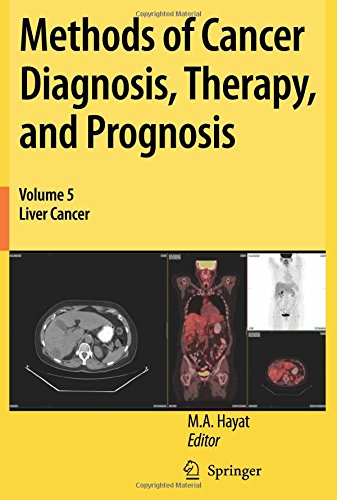Methods of Cancer Diagnosis, Therapy, and Prognosis: Liver Cancer