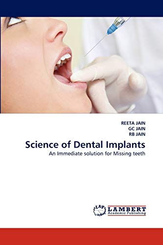Science of Dental Implants: An Immediate solution for Missing teeth