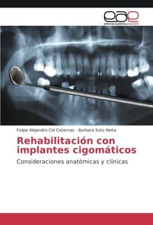 Rehabilitación con implantes cigomáticos: Consideraciones anatómicas y clínicas
