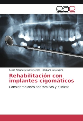 Rehabilitación con implantes cigomáticos: Consideraciones anatómicas y clínicas