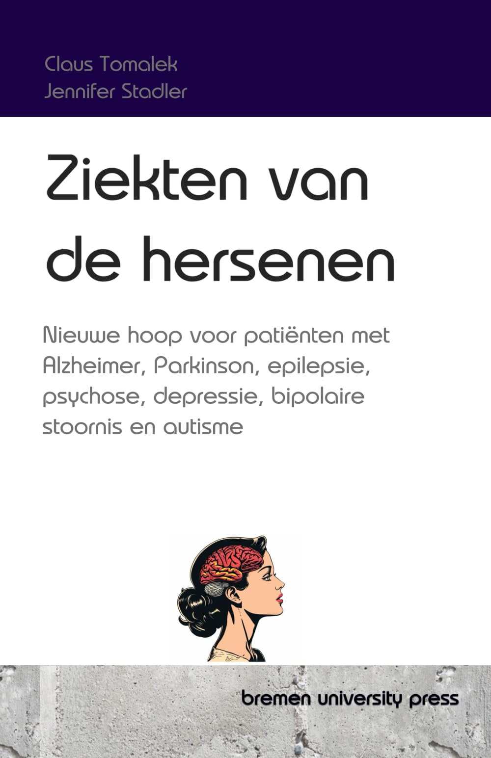 Ziekten van de hersenen: Nieuwe hoop voor patiënten met Alzheimer, Parkinson, epilepsie, psychose, depressie, bipolaire stoornis en autisme