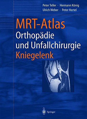 MRT-Atlas Orthopädie und Unfallchirurgie: Kniegelenk (German Edition)