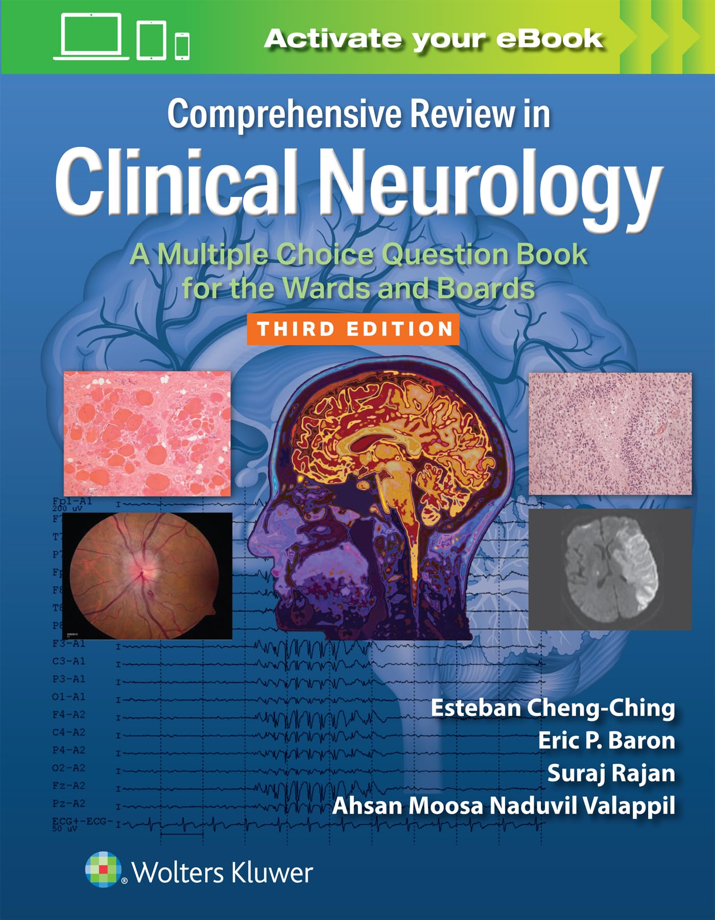 Valappil, Ahsan Moosa Naduvil: Comprehensive Review in Clinical Neurology