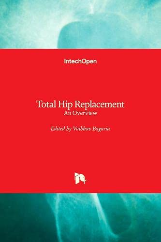Total Hip Replacement: An Overview