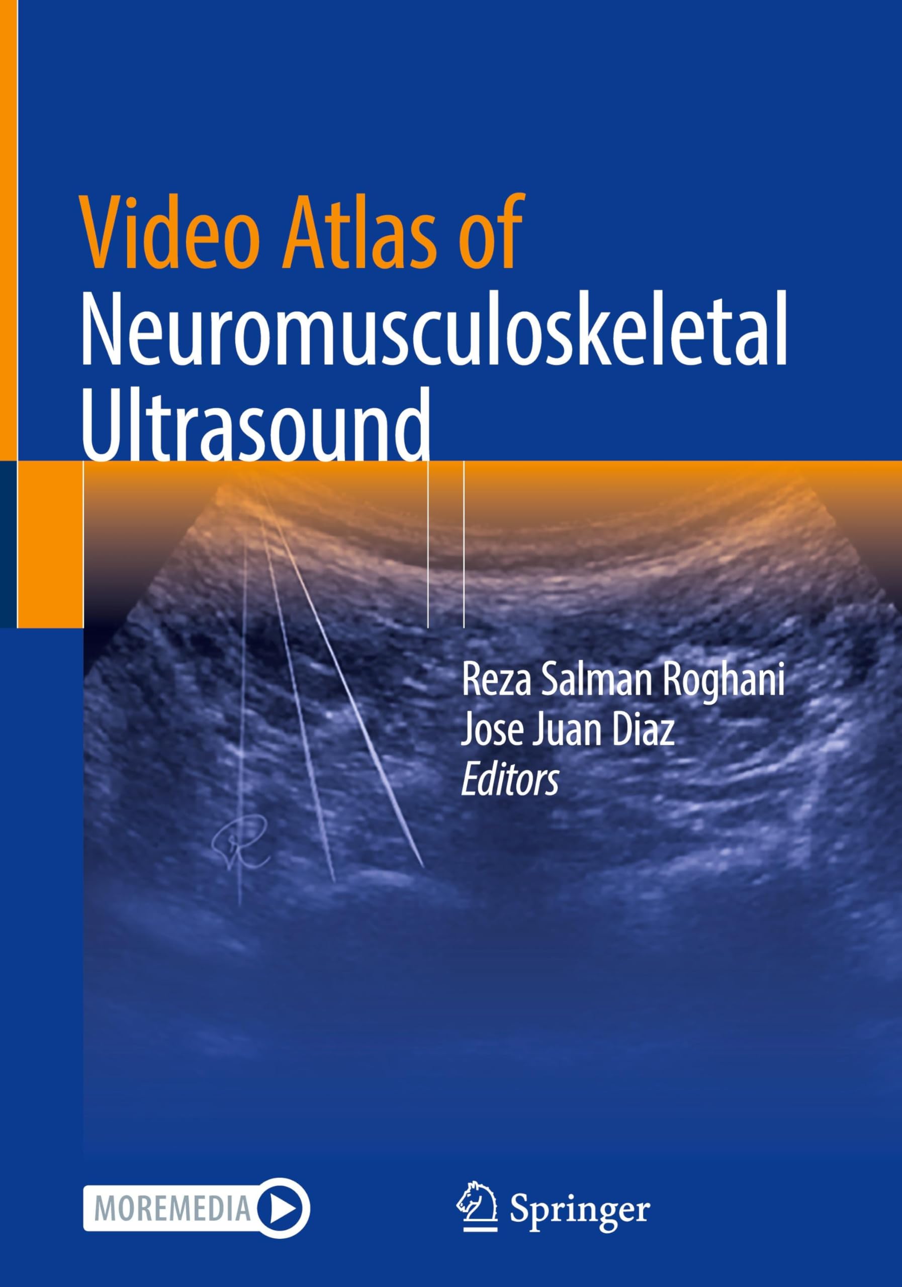 Video Atlas of Neuromusculoskeletal Ultrasound: With Online Files