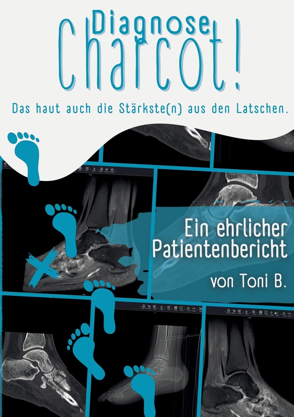 Diagnose Charcot!: Das haut auch die Stärkste(n) aus den Latschen.