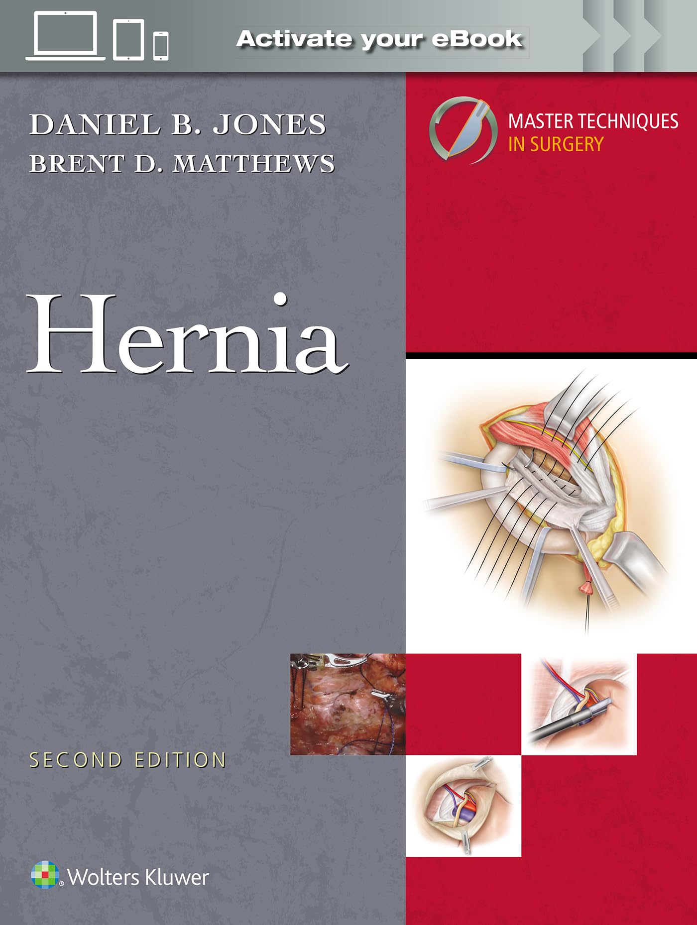 Master Techniques in Surgery: Hernia: Print + eBook with Multimedia: With Online Files