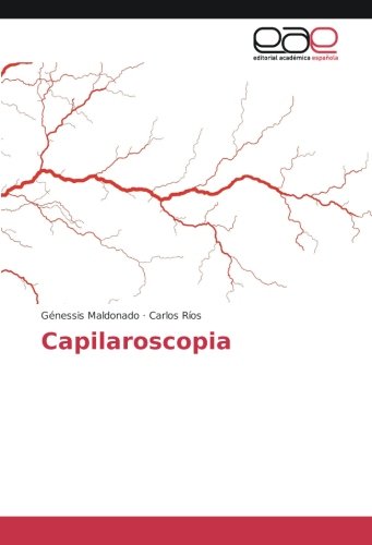 Capilaroscopia