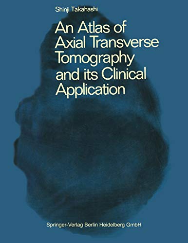 An Atlas of Axial Transverse Tomography and its Clinical Application