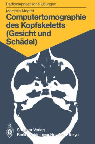 Computertomographie des Kopfskeletts (Gesicht und Schädel): 58 Diagnostische Übungen für Studenten und Praktische Radiologen (Radiodiagnostische Übungen)