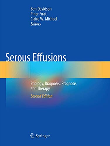 Serous Effusions: Etiology, Diagnosis, Prognosis and Therapy