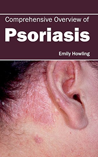 Emily Howling Comprehensive Overview Of Psoriasis