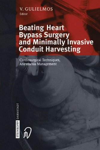 Beating Heart Bypass Surgery and Minimally Invasive Conduit Harvesting: Cardiosurgical Techniques, Anesthesia Management
