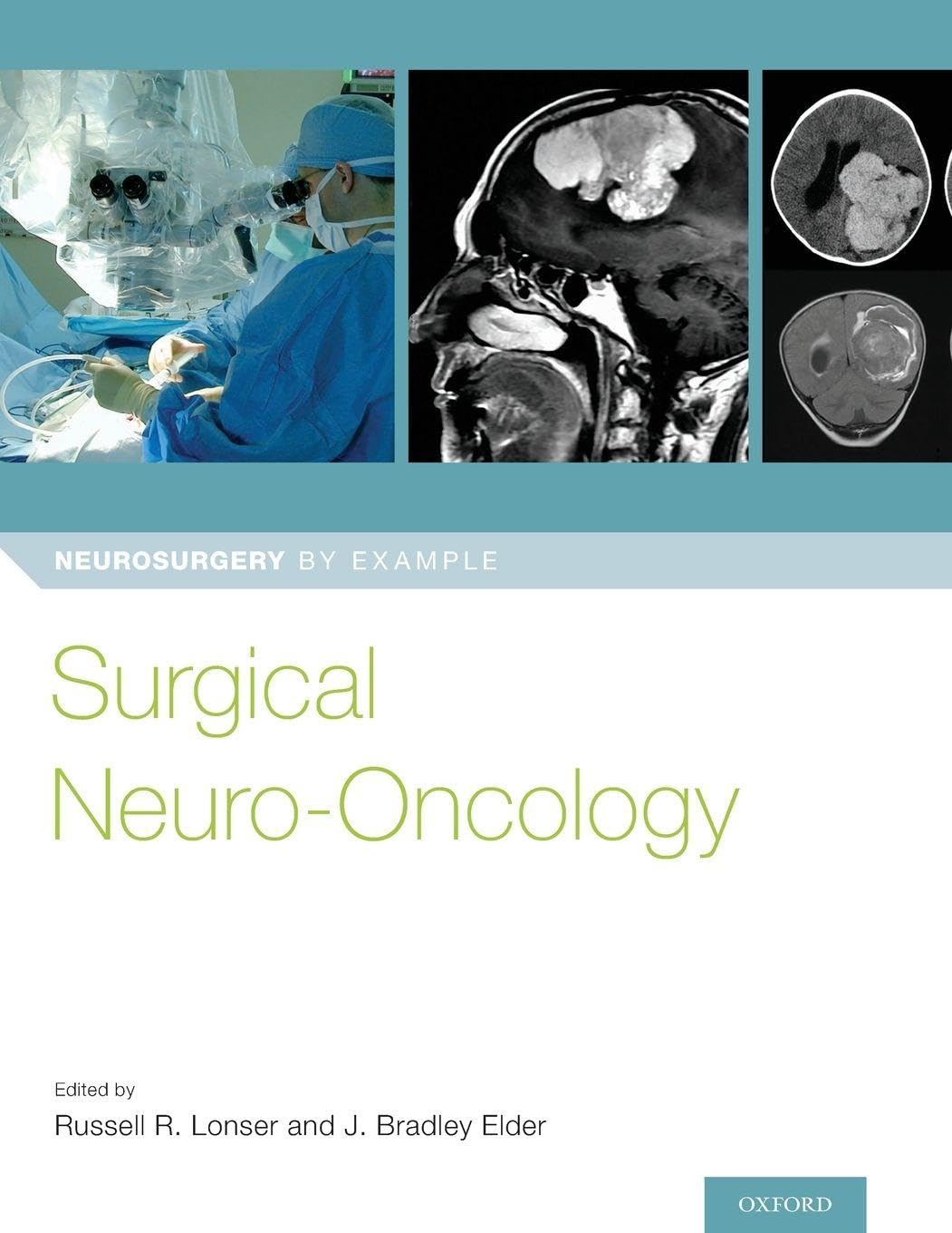 Surgical Neuro-Oncology (Neurosurgery by Example)