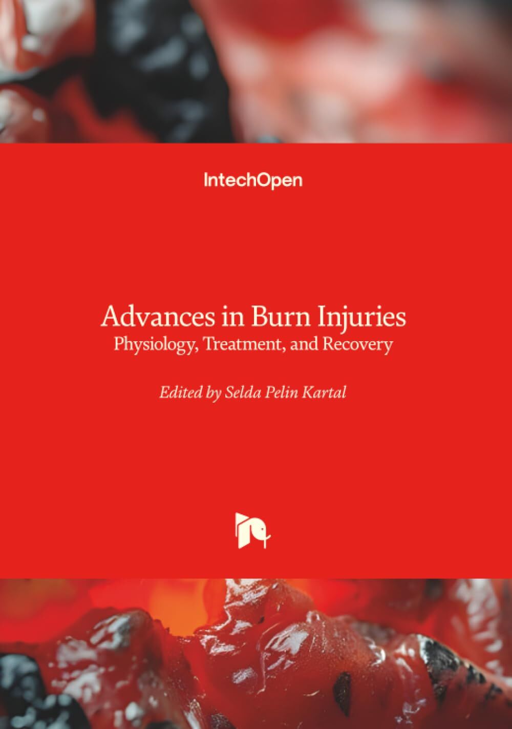 Advances in Burn Injuries - Physiology, Treatment, and Recovery