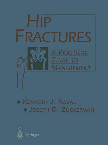 Hip Fractures: A Practical Guide To Management
