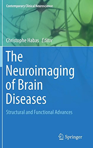 The Neuroimaging of Brain Diseases: Structural and Functional Advances (Contemporary Clinical Neuroscience)