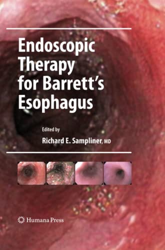 Endoscopic Therapy for Barrett's Esophagus (Clinical Gastroenterology)