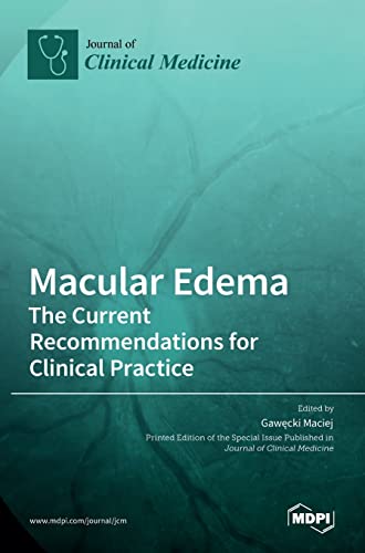 Macular Edema: The Current Recommendations for Clinical Practice