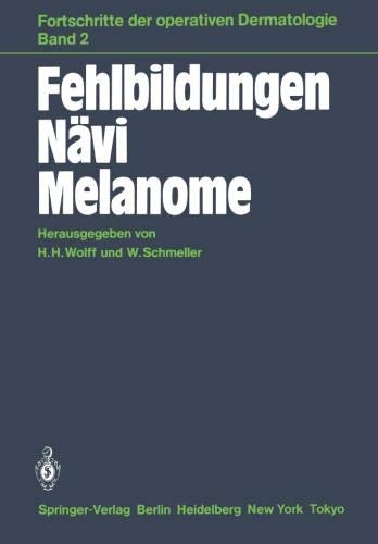 Fehlbildungen Nävi Melanome (Fortschritte der operativen und onkologischen Dermatologie, Band 2)