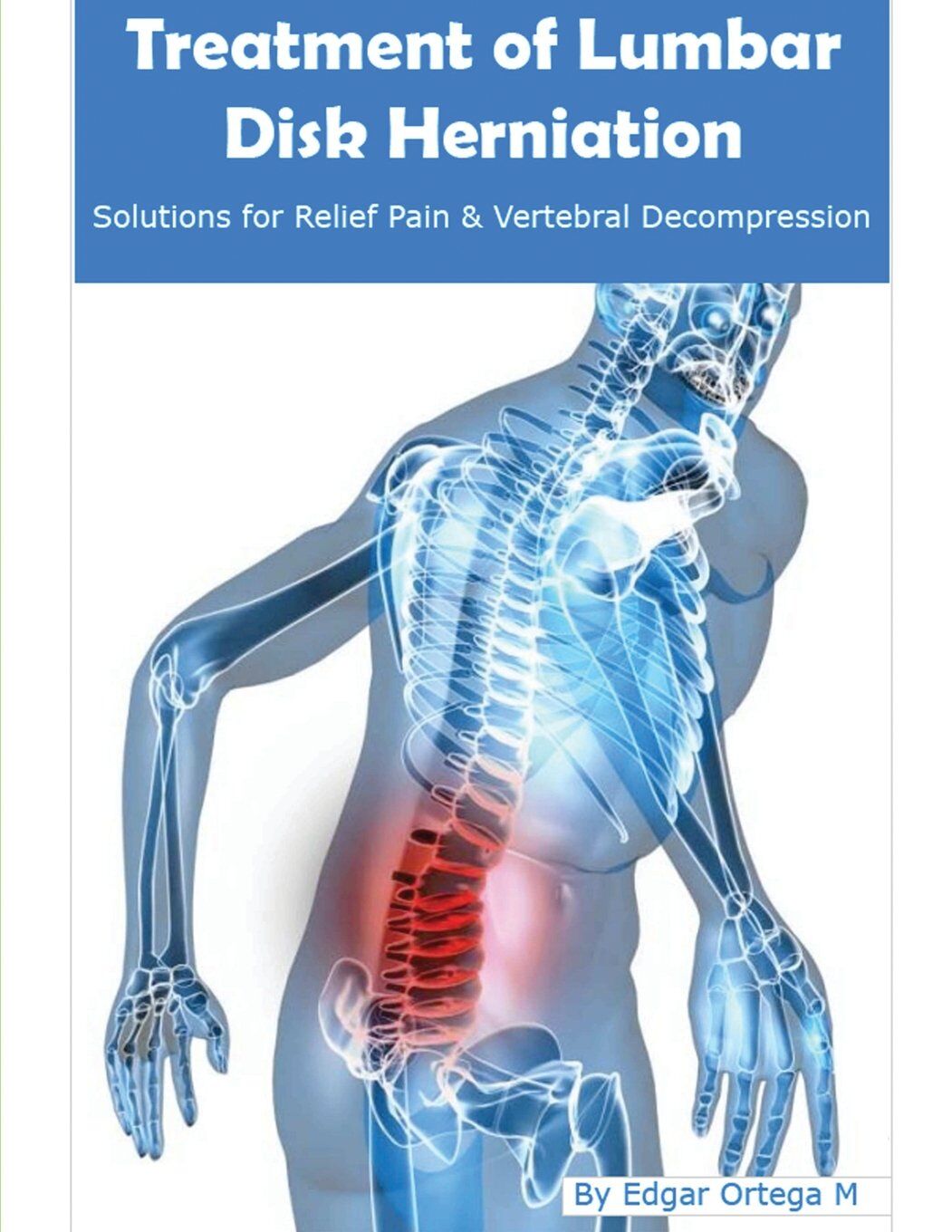 Maldonado, Edgar Ortega Treatment Of Lumbar Disk Herniation, Back Pain Relief And Herniated Discs Solutions