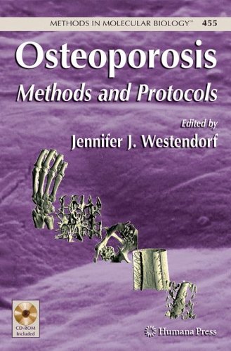 Osteoporosis: Methods and Protocols: Preliminary Entry 2022 (Methods in Molecular Biology)