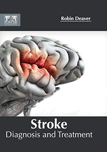 Stroke: Diagnosis and Treatment