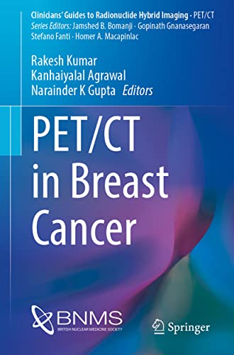 PET/CT in Breast Cancer (Clinicians’ Guides to Radionuclide Hybrid Imaging)