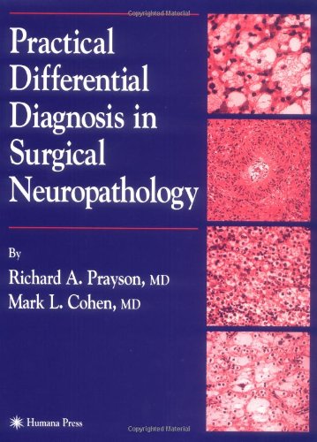 Practical Differential Diagnosis in Surgical Neuropathology