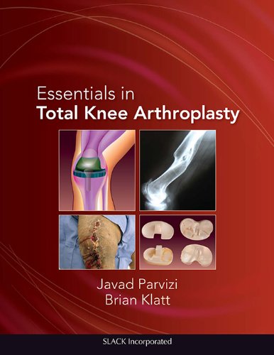 Parvizi, J: Essentials in Total Knee Arthroplasty (Parvizi, Essentials in Total Knee Arthroplasty)