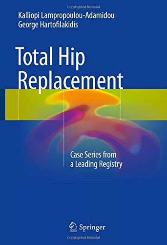 Total Hip Replacement: Case Series from a Leading Registry