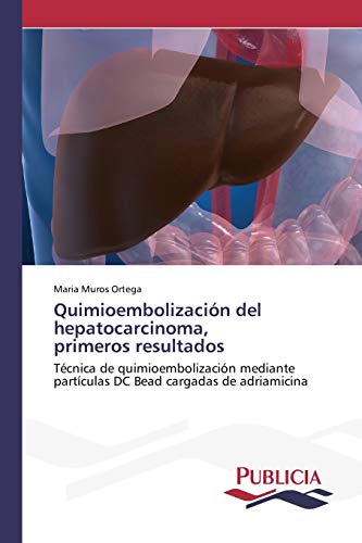 Quimioembolización del hepatocarcinoma, primeros resultados: Técnica de quimioembolización mediante partículas DC Bead cargadas de adriamicina