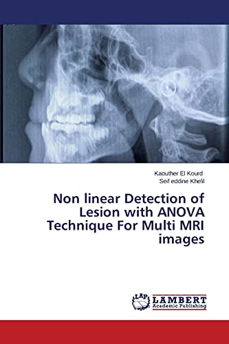 Non linear Detection of Lesion with ANOVA Technique For Multi MRI images