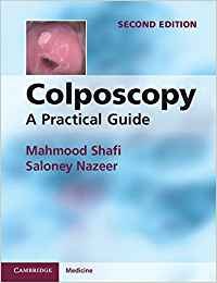 Colposcopy: A Practical Guide