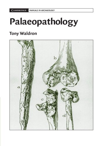 Palaeopathology (Cambridge Manuals in Archaeology)