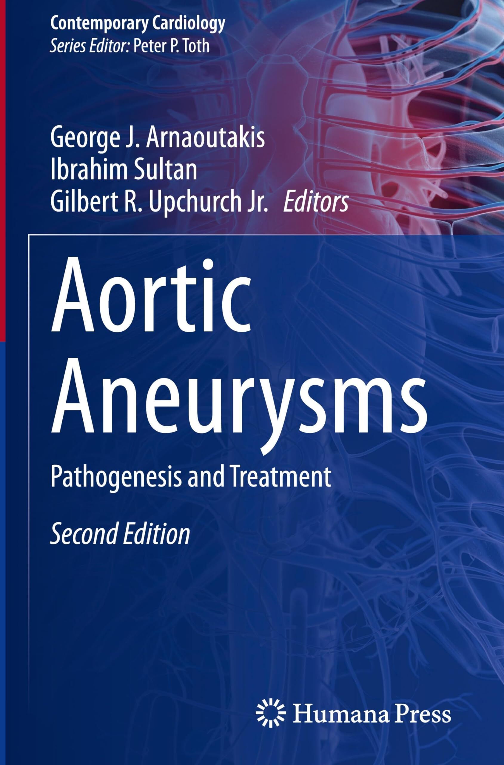 Aortic Aneurysms