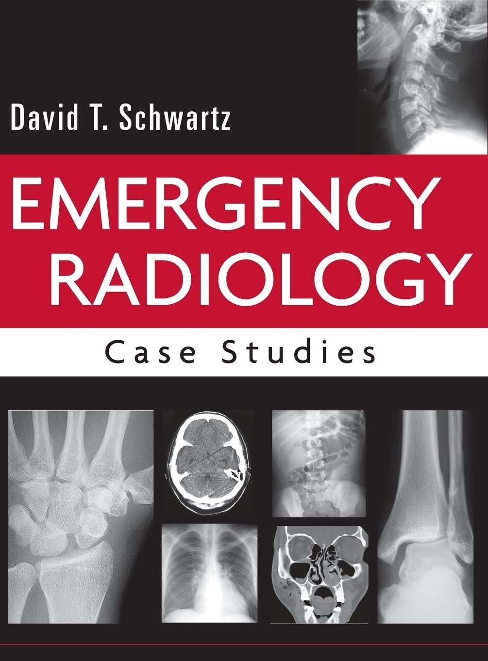 Emergency Radiology