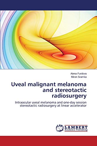 Uveal malignant melanoma and stereotactic radiosurgery: Intraocular uveal melanoma and one-day session stereotactic radiosurgery at linear accelerator