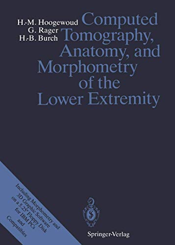Computed Tomography, Anatomy, and Morphometry of the Lower Extremity: Book + Online Access