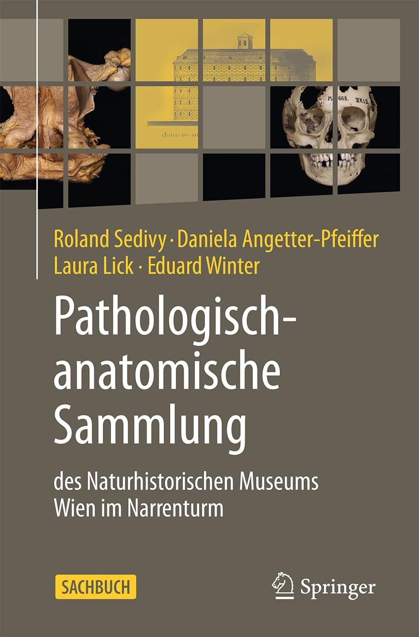 Pathologisch-anatomische Sammlung des Naturhistorischen Museums Wien im Narrenturm