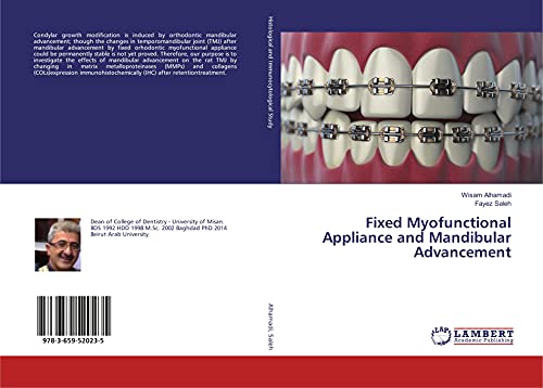 Fixed Myofunctional Appliance and Mandibular Advancement