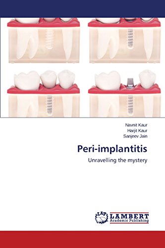 Peri-implantitis: Unravelling the mystery
