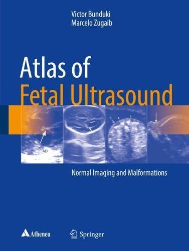 Atlas of Fetal Ultrasound - Victor Bunduki Marcelo Zugaib Gebunden