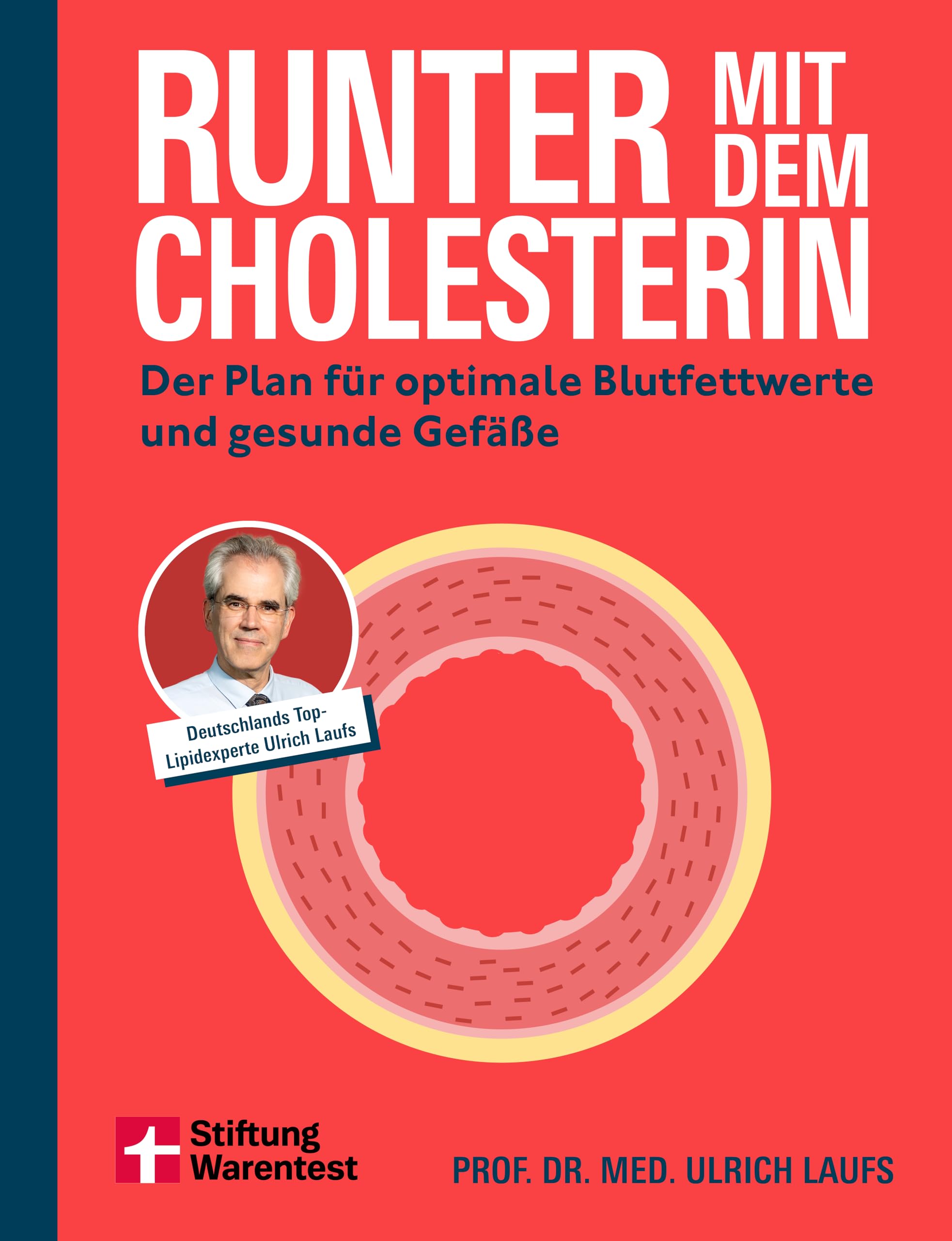 Laufs, Ulrich: Runter mit dem Cholesterin